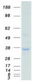 SDS-PAGE (RPA2-3103H).jpg